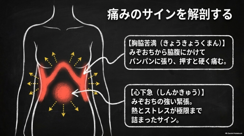 痛みのサイン：みぞおちから脇腹が張る胸脇苦満と、みぞおちの強い緊張・心下急