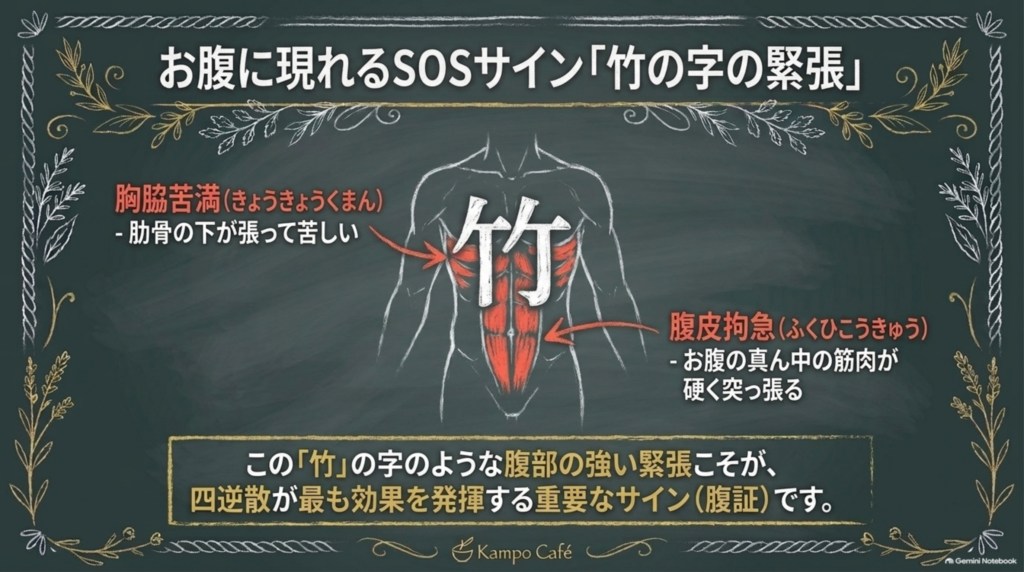 お腹に現れる竹の字の緊張（胸脇苦満と腹皮拘急）
