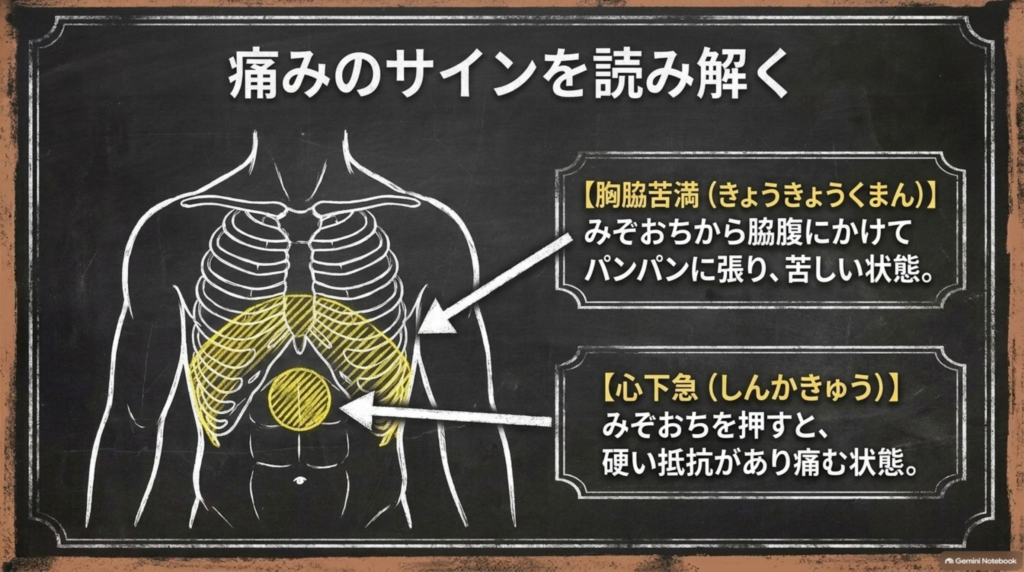 痛みのサインを読み解く：胸脇苦満と心下急の位置