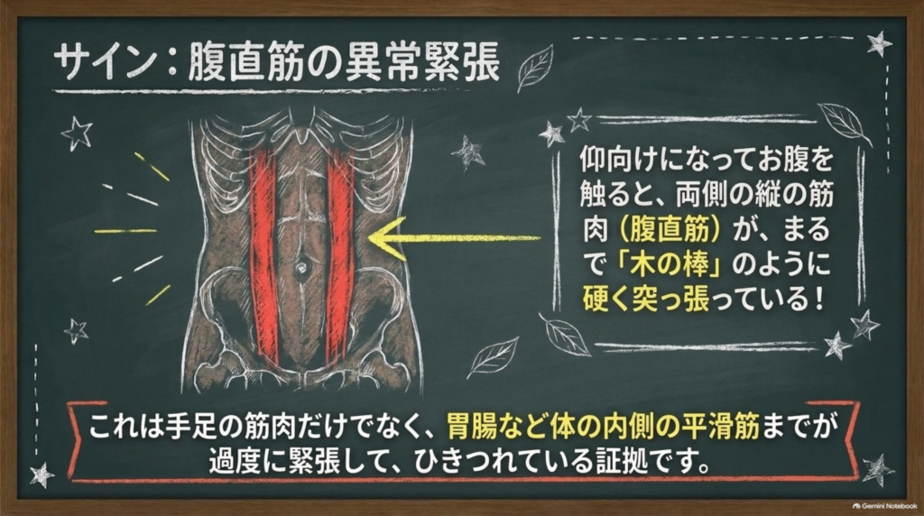 腹直筋が棒のように硬く突っ張る腹証のサイン