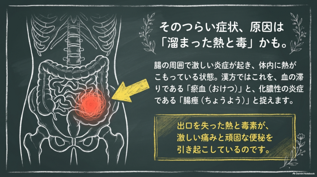 つらい症状の原因は「溜まった熱と毒」かも。漢方では血の滞り「瘀血（おけつ）」と化膿性の炎症「腸癰（ちょうよう）」と捉えます