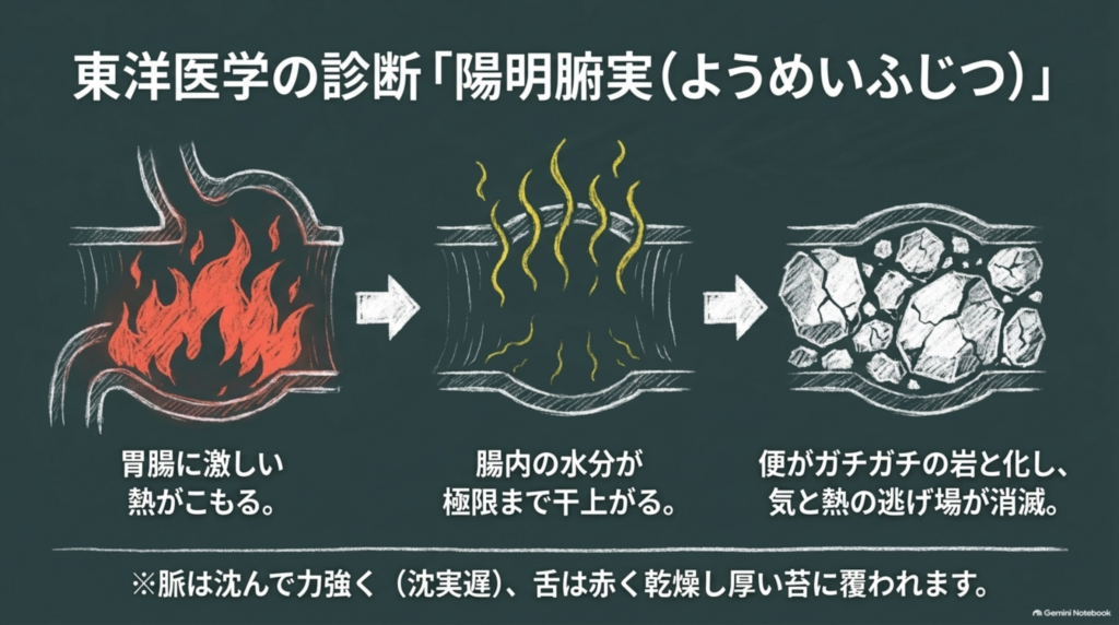 東洋医学の診断「陽明腑実」：胃腸に激しい熱がこもり、腸内の水分が干上がり、便が岩のように固まる