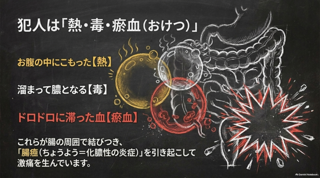 犯人は「熱・毒・瘀血」。お腹にこもった熱、溜まって膿となる毒、ドロドロに滞った血が腸の周囲で結びつき激痛を生む