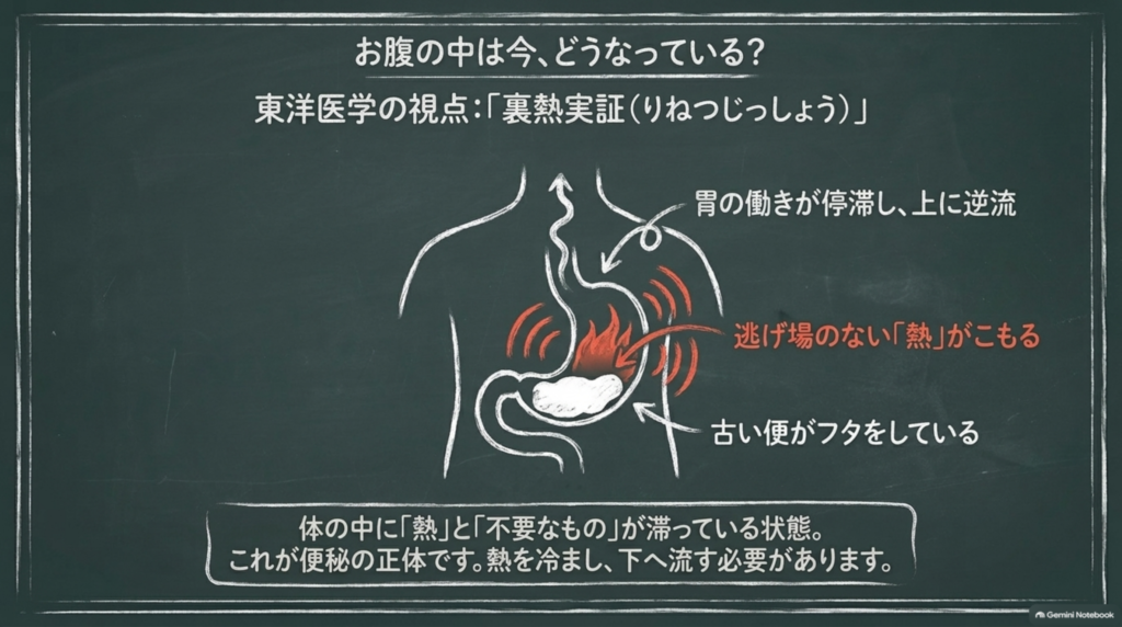 お腹の中は今どうなっている？古い便がフタをして熱がこもり、胃の働きが停滞して上に逆流する