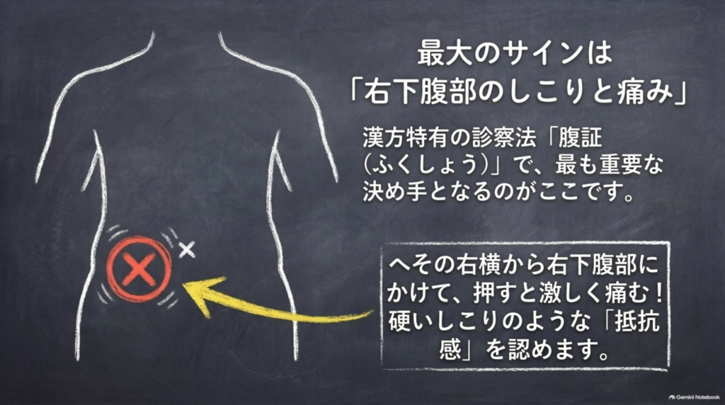 最大のサインは「右下腹部のしこりと痛み」。漢方特有の診察法「腹証」で最も重要な決め手