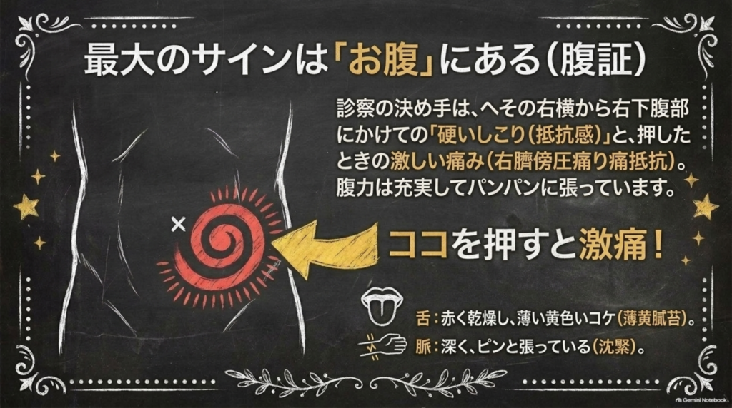 腹証：へその右横から右下腹部にかけて硬いしこりがあり、押すと激しく痛む。舌は赤く乾燥し薄い黄色の苔、脈は深く張っている